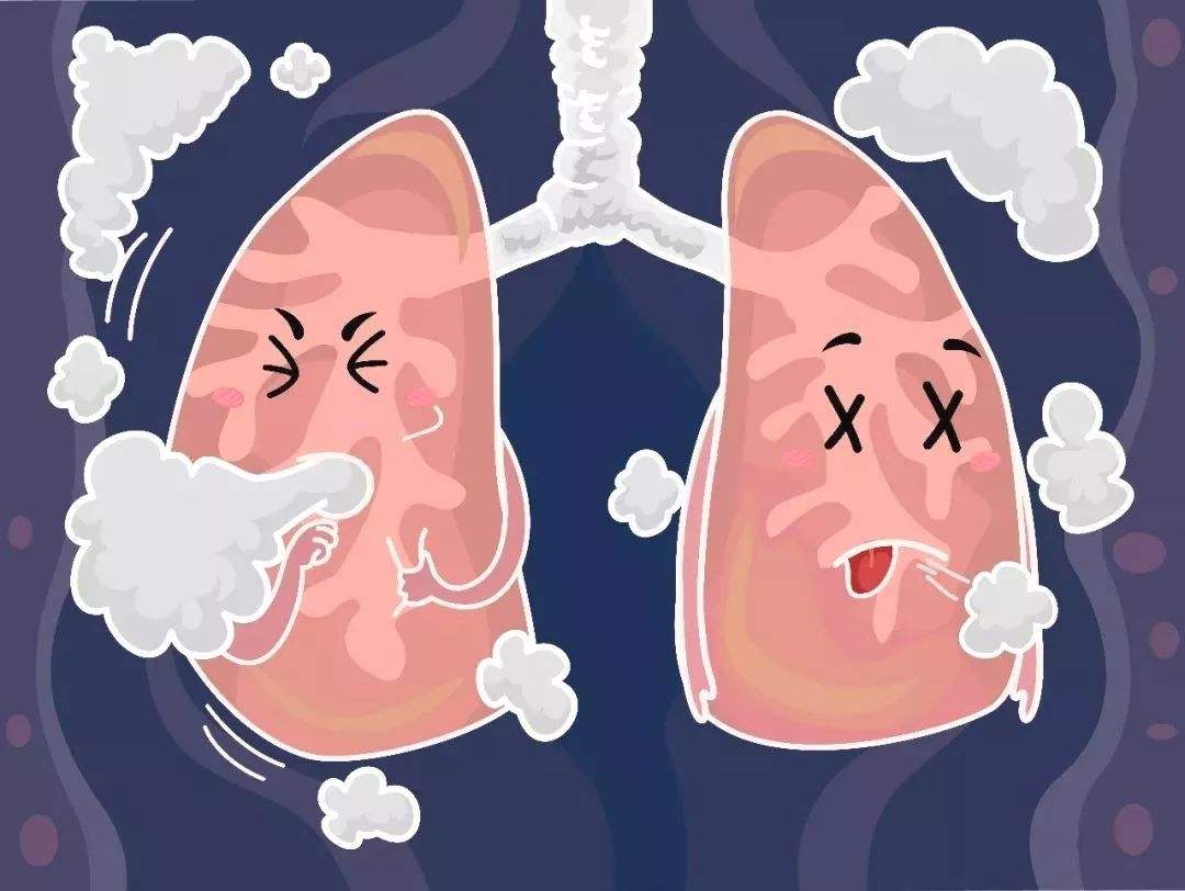 A Few Tips to Manage Your COPD